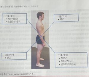 하부교차증후군